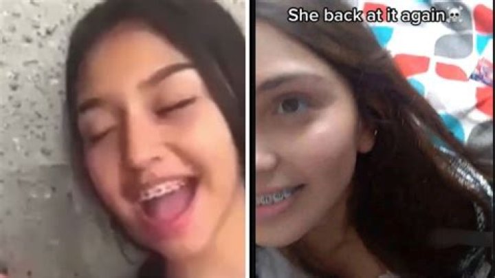 
Girl Slicing Thigh Open On Tiktok, Find The Full Video & Twitter Reaction 