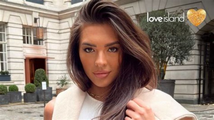 
What Happened To Love Island Gemma Owen’s Teeth Has She Used Braces And Whitened Them 