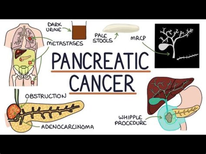 
What happened to Maria Menounos? Pancreatic cancer early symptoms explored in wake of health revelation 